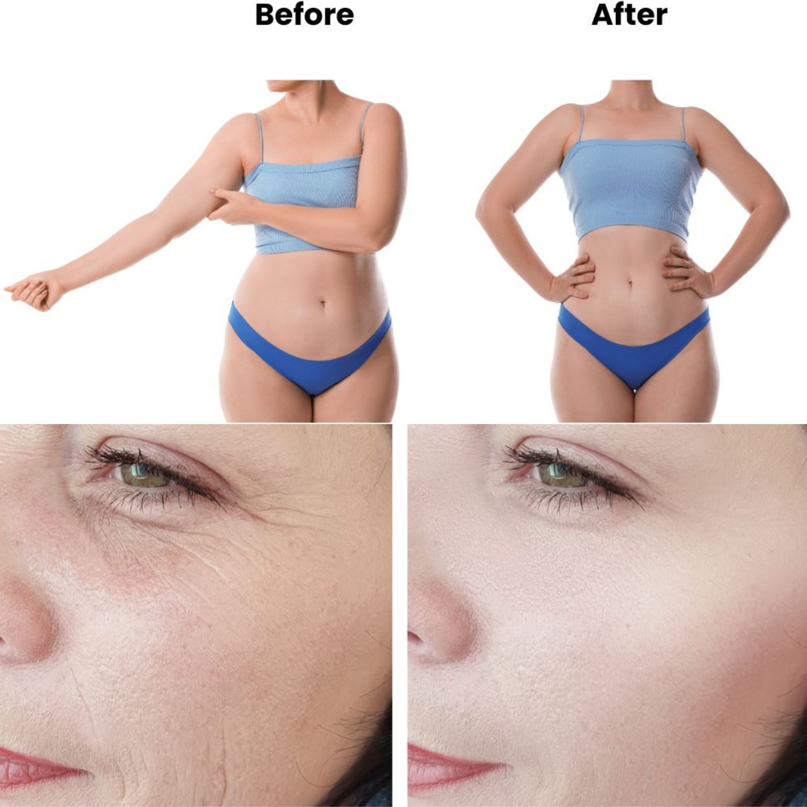 cavitation before and after results