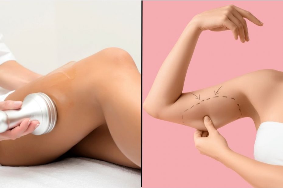 Cavitation vs Liposuction