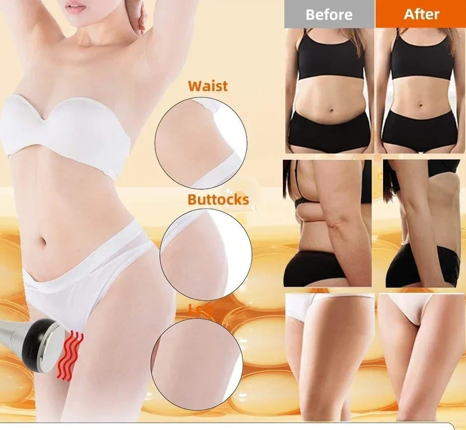 4 in 1 at home 40k cavitation machine